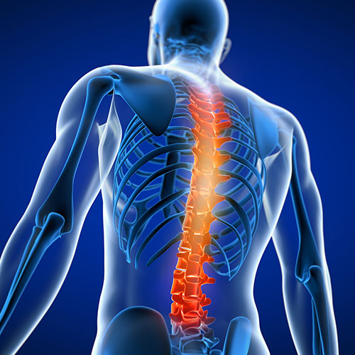 medical illustration of back pain